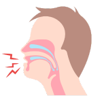 Advanced Airway Management